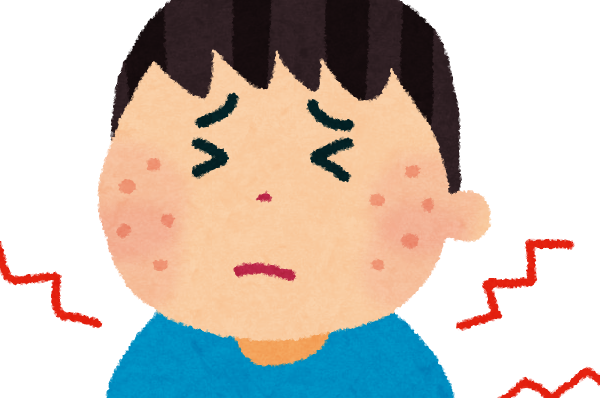 アトピーは実はグルテンが原因だった？アトピー性皮膚炎とグルテンフリー